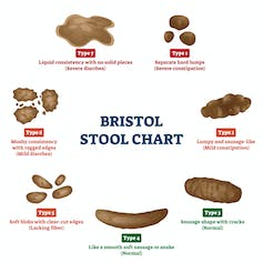 A chart displays the different types of poos as categorised by the Bristol Stool Chart.