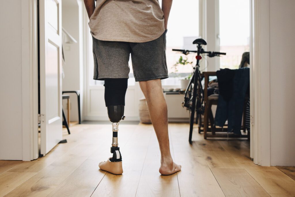 A photograph of a man from the waist down who is facing away from the camera. He has his hands in the pockets of his shorts. His left leg is a prosthetic.